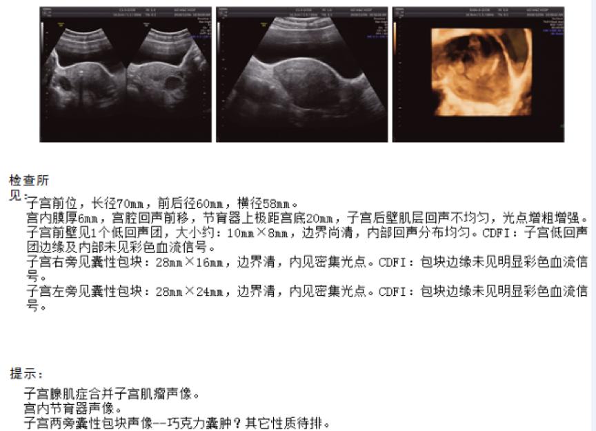 戈舍瑞林最新价格，市场趋势与影响因素分析